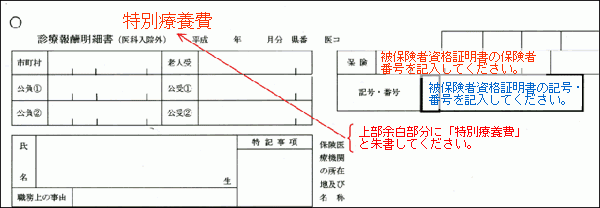 レセプトイメージ